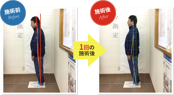 A.M様の施術前と施術後の比較