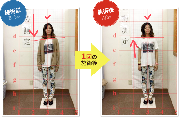 石川千夏様の施術前と施術後の比較